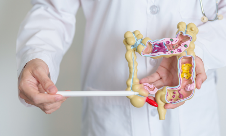 Darm Detox: Ondersteun je Darmen met Gut Cleanse Capsules